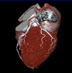 A Cardio-CT és a PET/CT életet menthet!